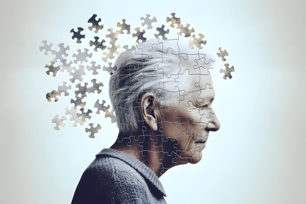 Alzheimer cuatro Alzheimer