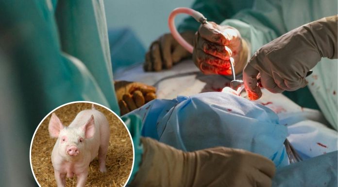 Xenotrasplante pulmonar: un avance médico histórico desde China Xenotrasplante Pulmonar